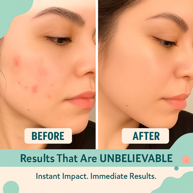 Dew+ Clear Pimple Care Patches – Fast & Gentle Relief